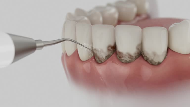 Reliable Dental Implants contractor in Ontario, CA by Smile Center Dentistry